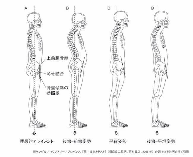 あなたの姿勢はどれ？姿勢分類について | 浅草橋駅前鍼灸接骨院